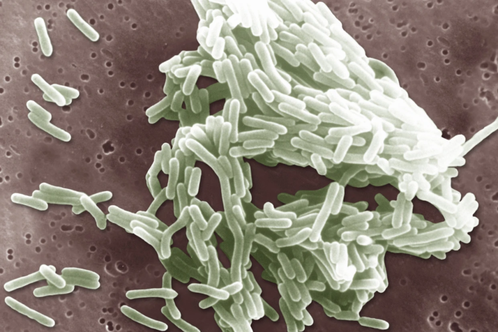 listeria image